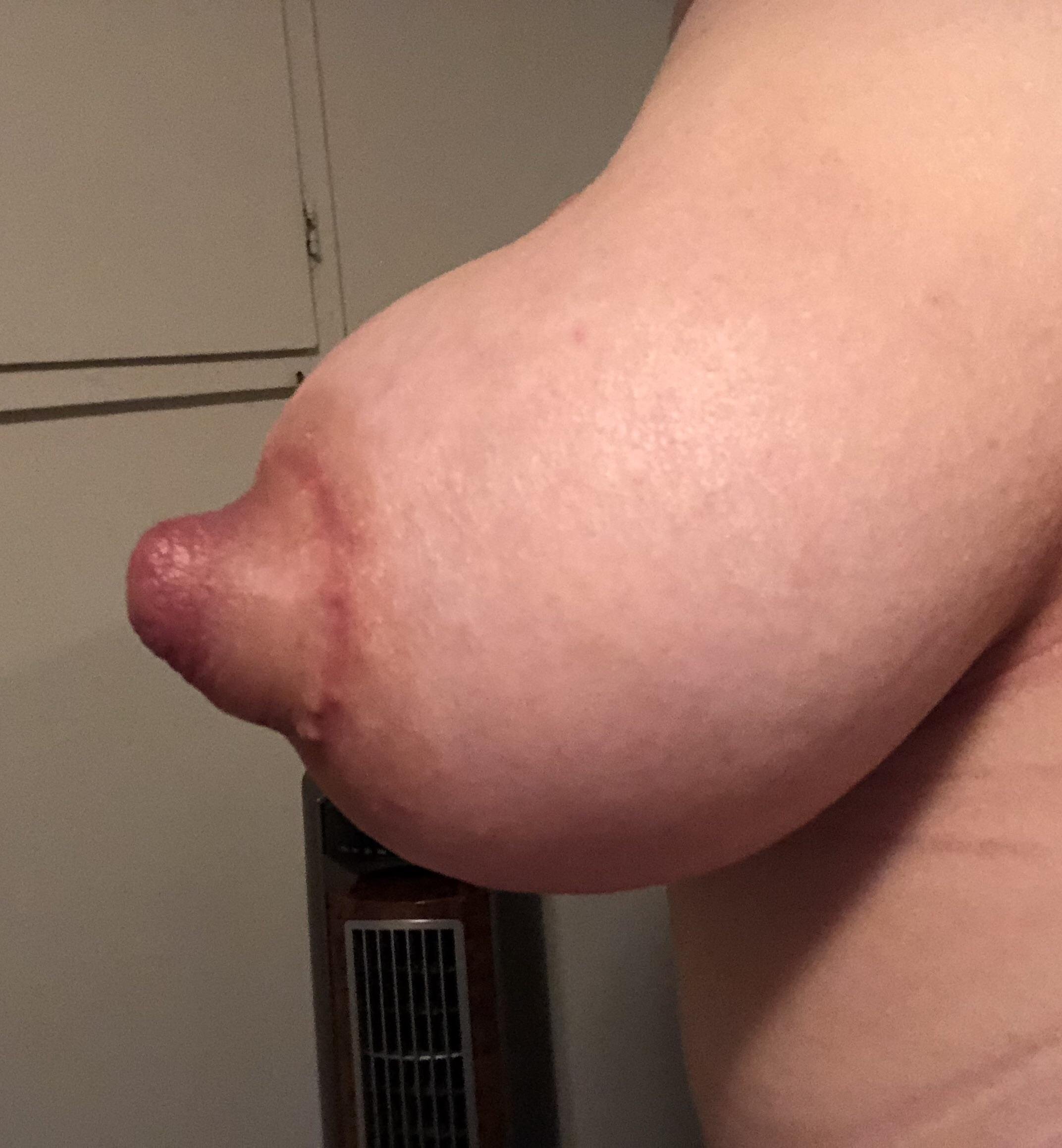 Another pic of the effects of 4 hours of suction teat training under my clothes while out in public