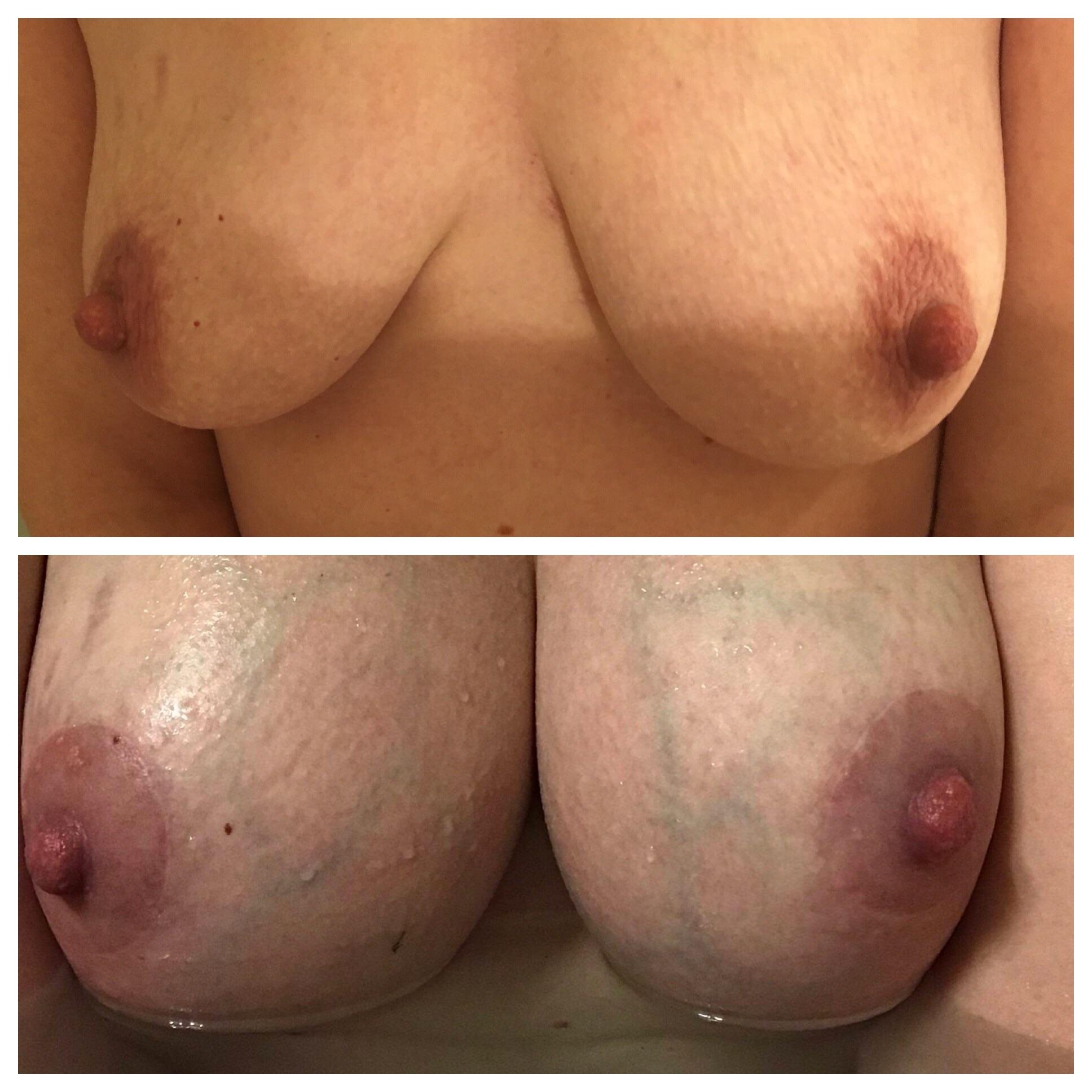 Wife’s boobs before and after. Comments welcome!