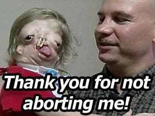 Thank you for not Aborting