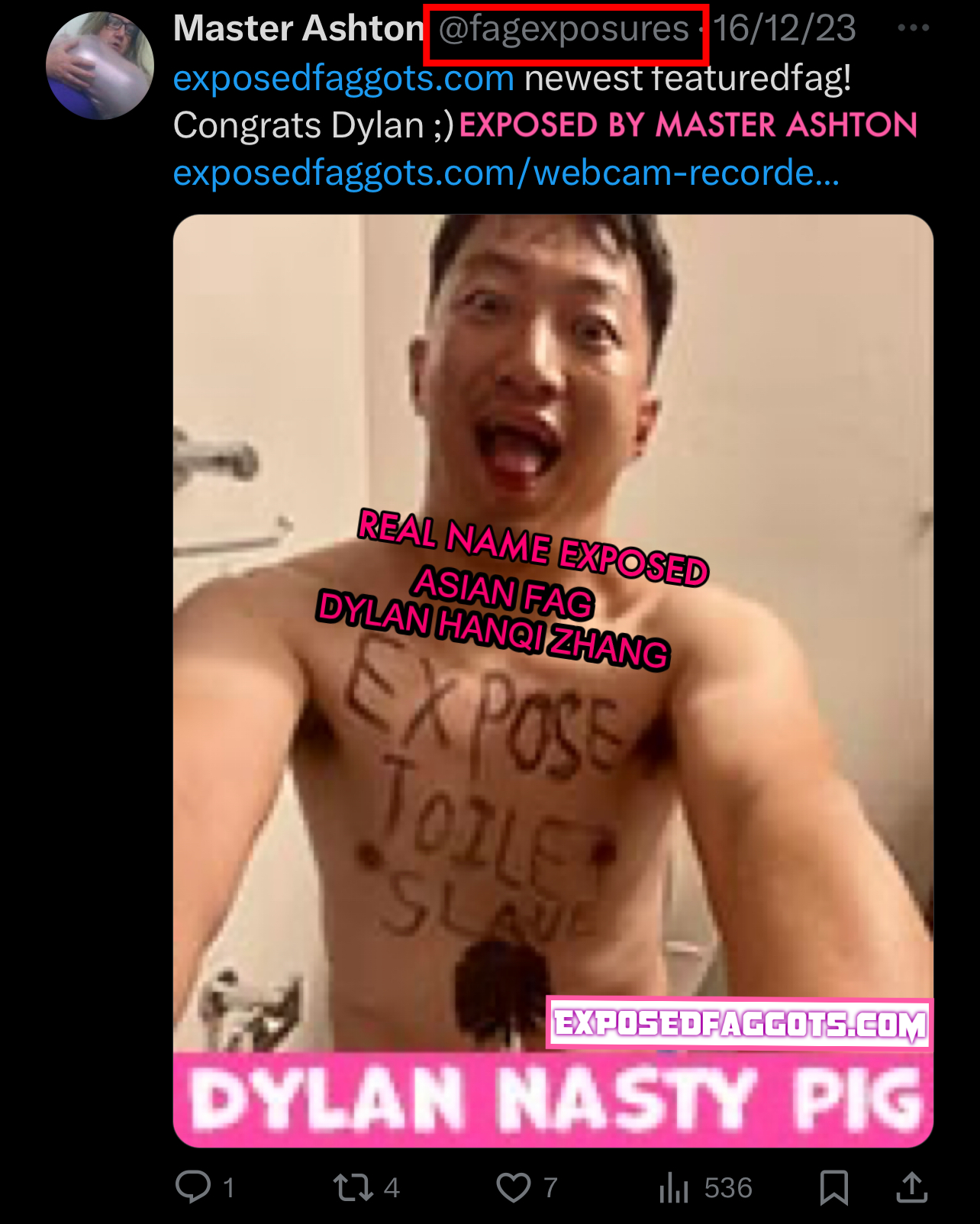 PERMANENTLY EXPOSED ASIAN FAG DYLAN HANQI ZHANG