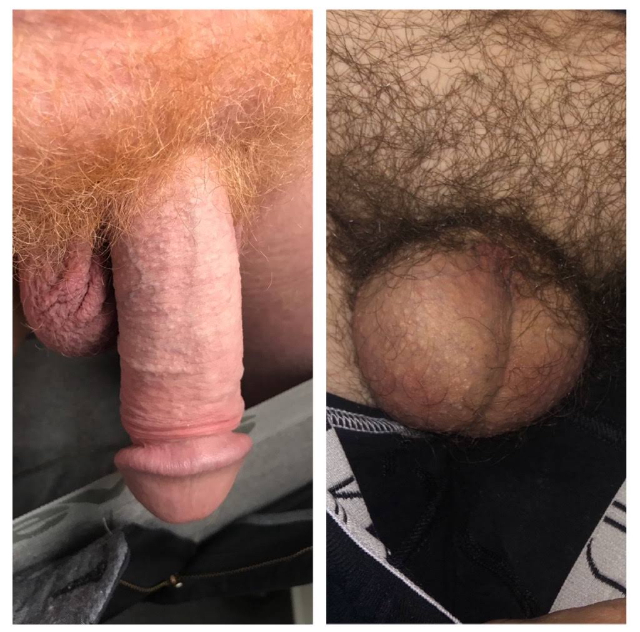 Real cock vs dickless fag. 