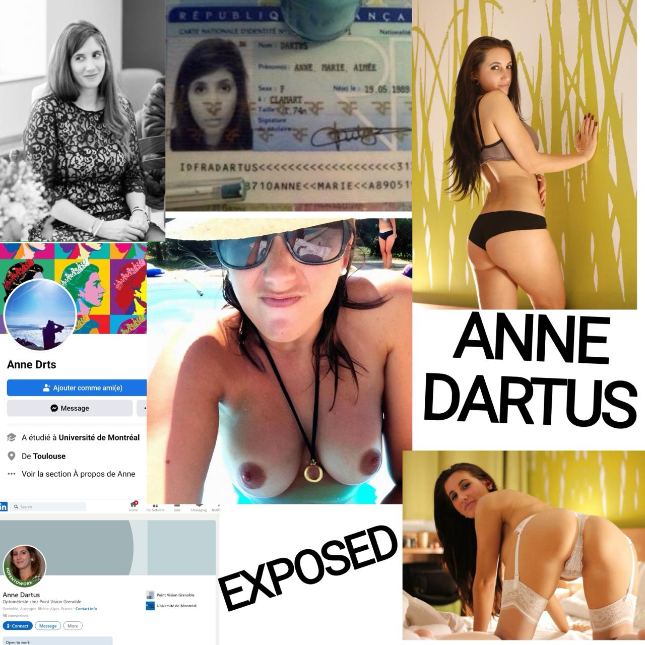 Anne Dartus is now a webslut 