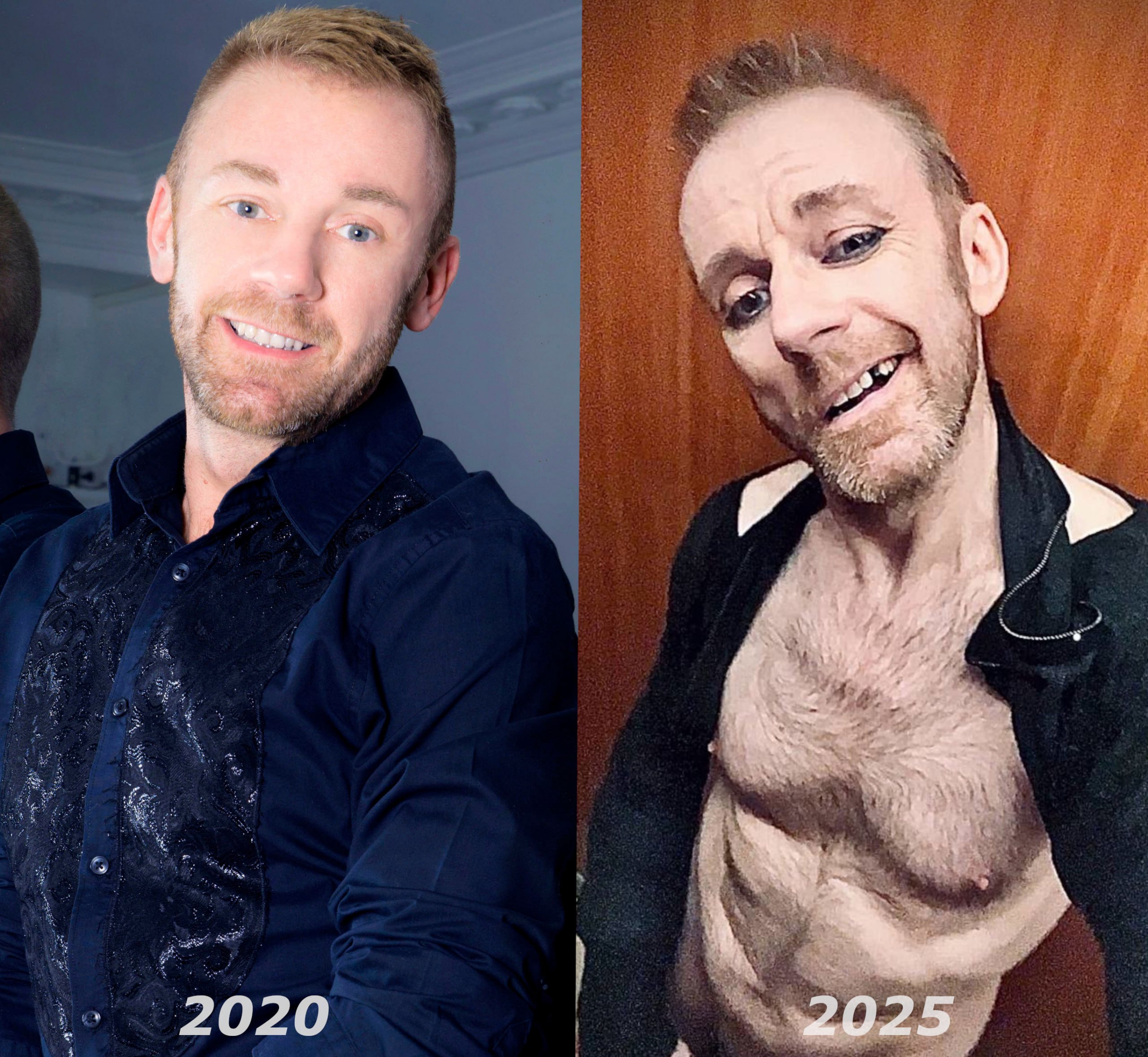 EYMERIC FRANCOIS (Tlgrm & X : @imfullyexposed)