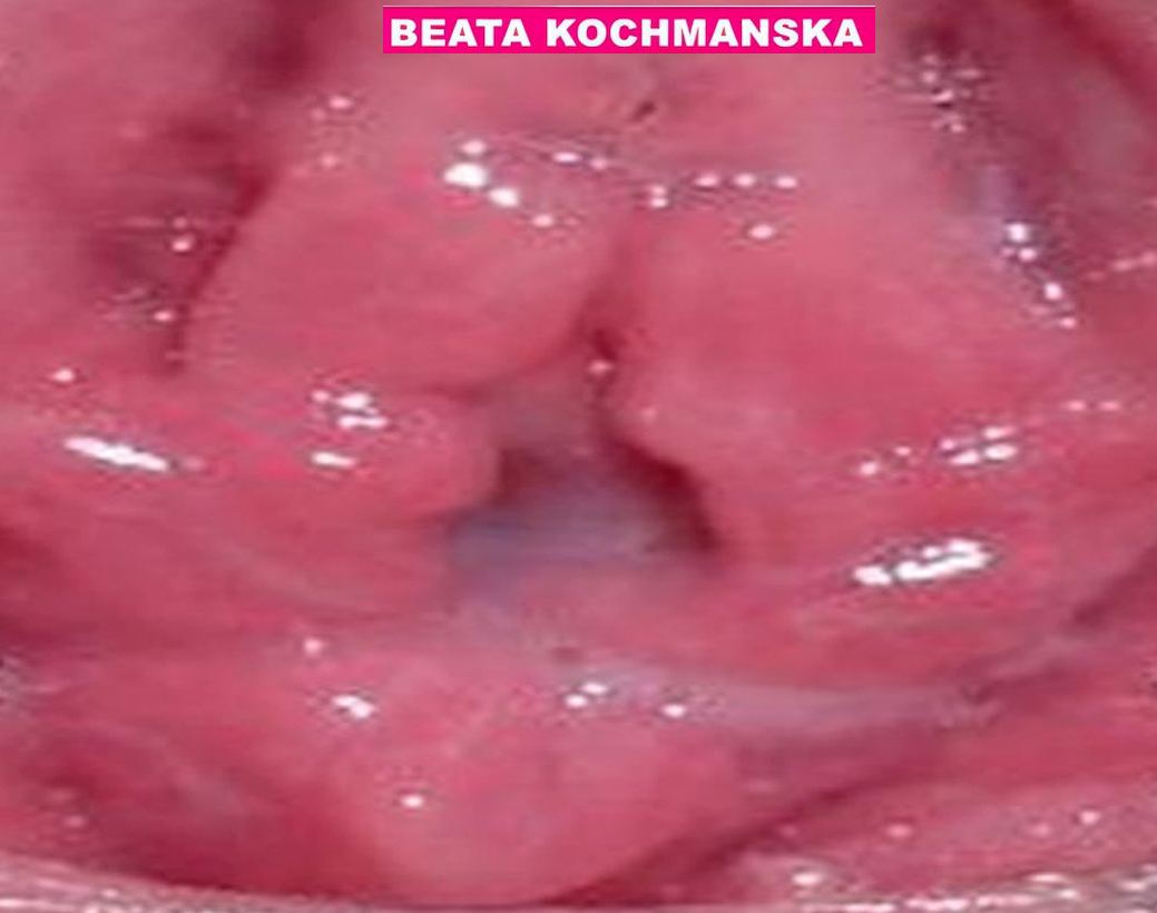 Hier Präsentiert DiE GEiLE HURE BEATA IHR GEiLES NASSES ROSA FiCKLOCH -EXTRA GANZ NAH FüR DiCH :-)