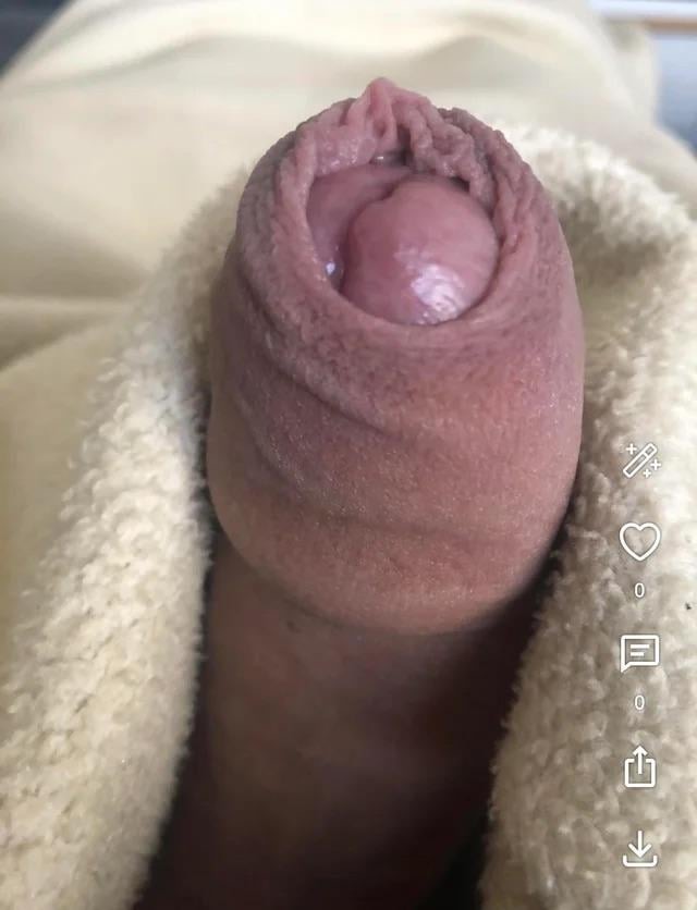 German Nudist19 yo Penis public cfnm 