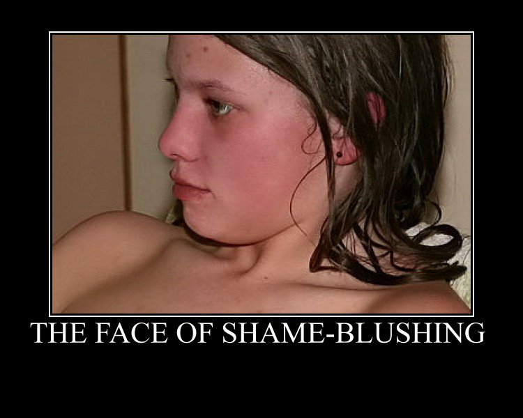 When FKK Naturists Become Uncomfortable.
