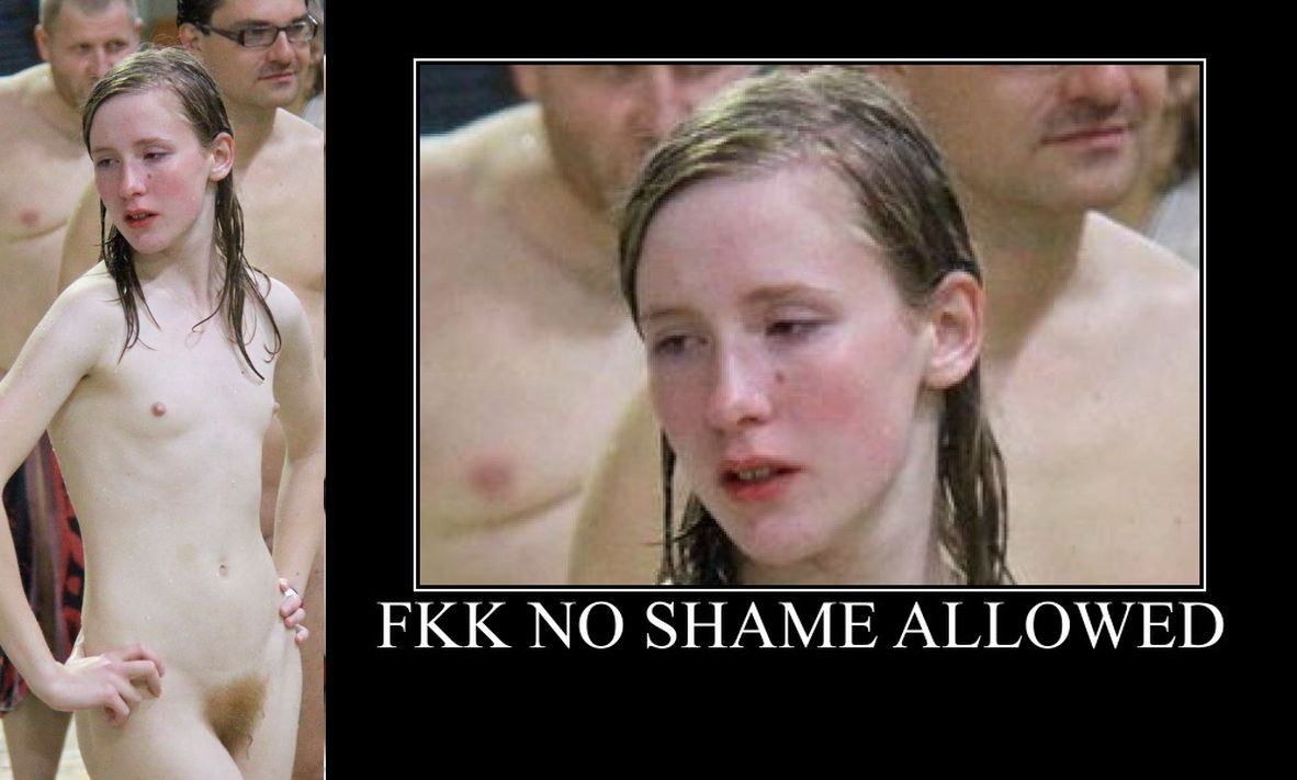 When FKK Naturists Become Uncomfortable.