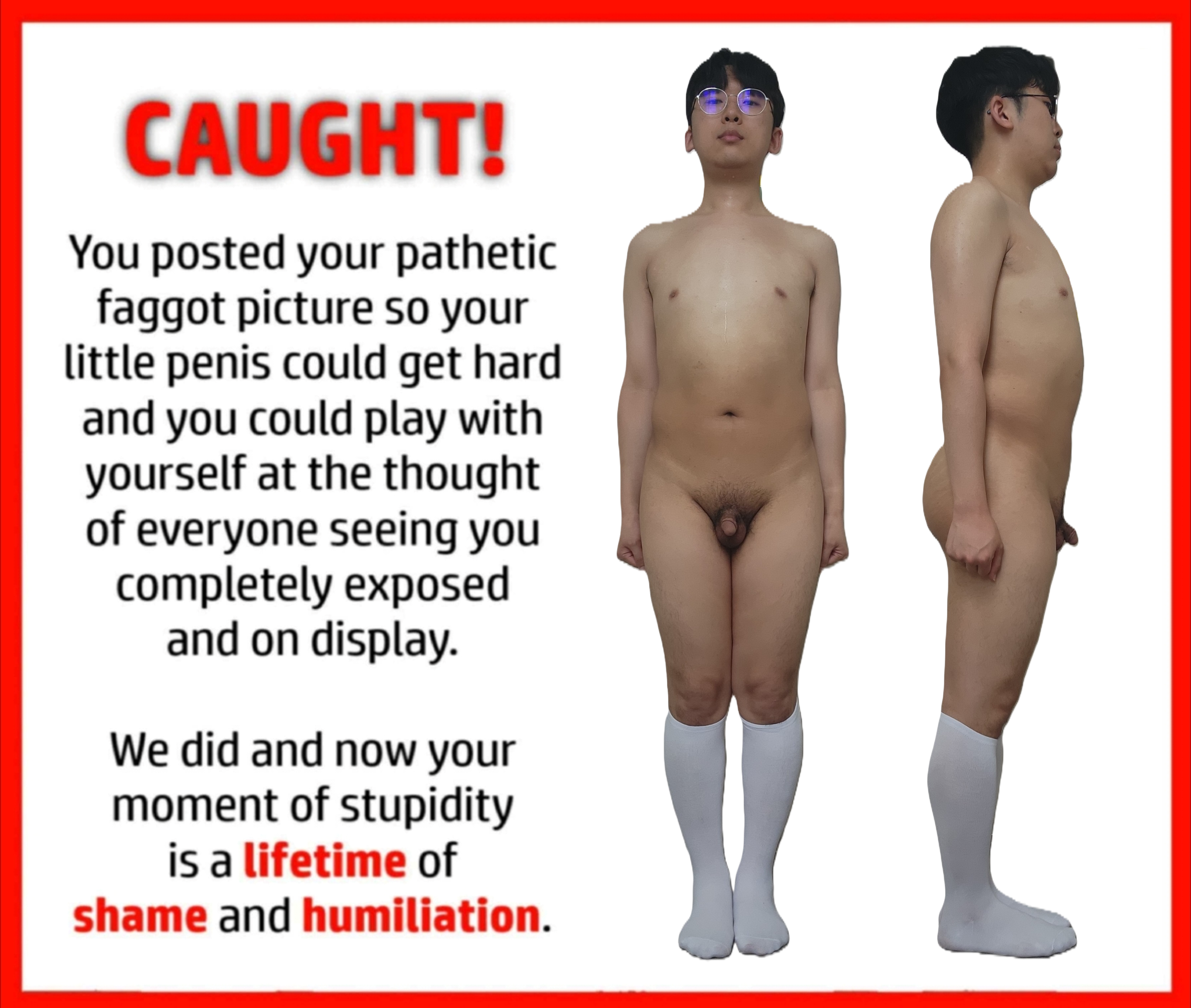 korean faggot exposed public domain