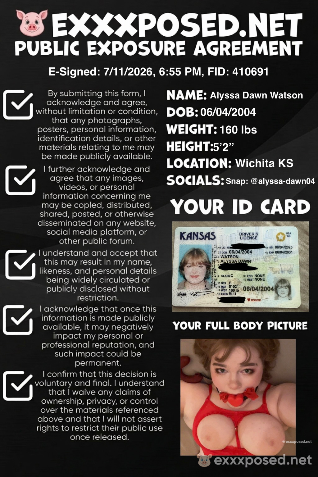 Slutty Dyke Alyssa Dawn Watson Exposed and Humiliated