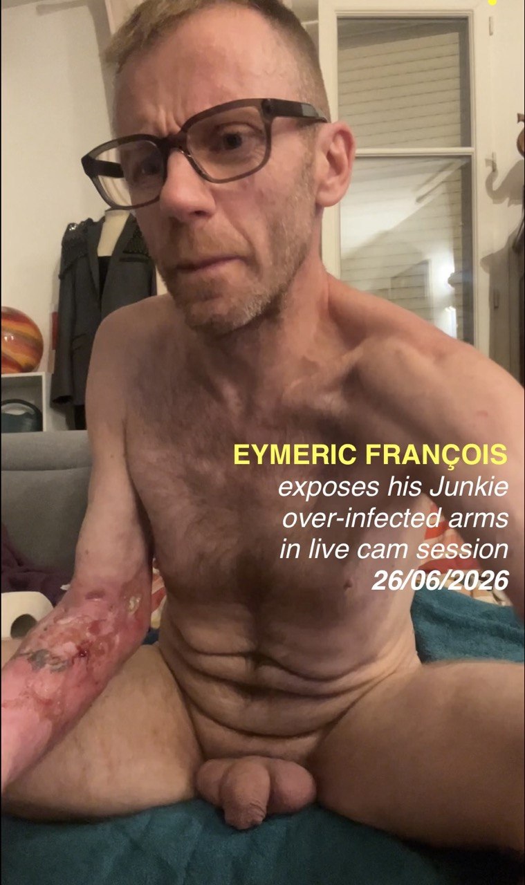 #eymericfrancoisexposedarms