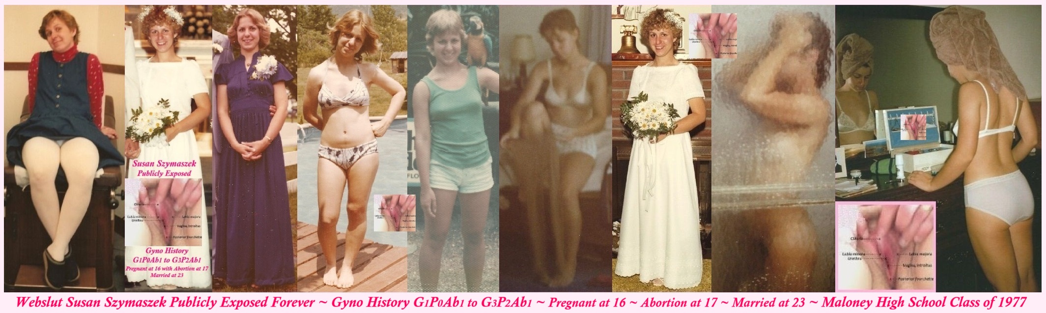 Susan Szymaszek Publicly Exposed Vagina Gyno G1P0Ab1 MHS1977 Webslut Pregnant at 16 Abortion at 17