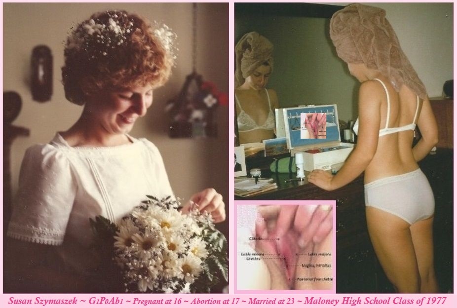 Blushing Bride Susan Szymaszek Dressed Undressed Exposed Vagina Gyno G1P0Ab1 Webslut Wife Pussy