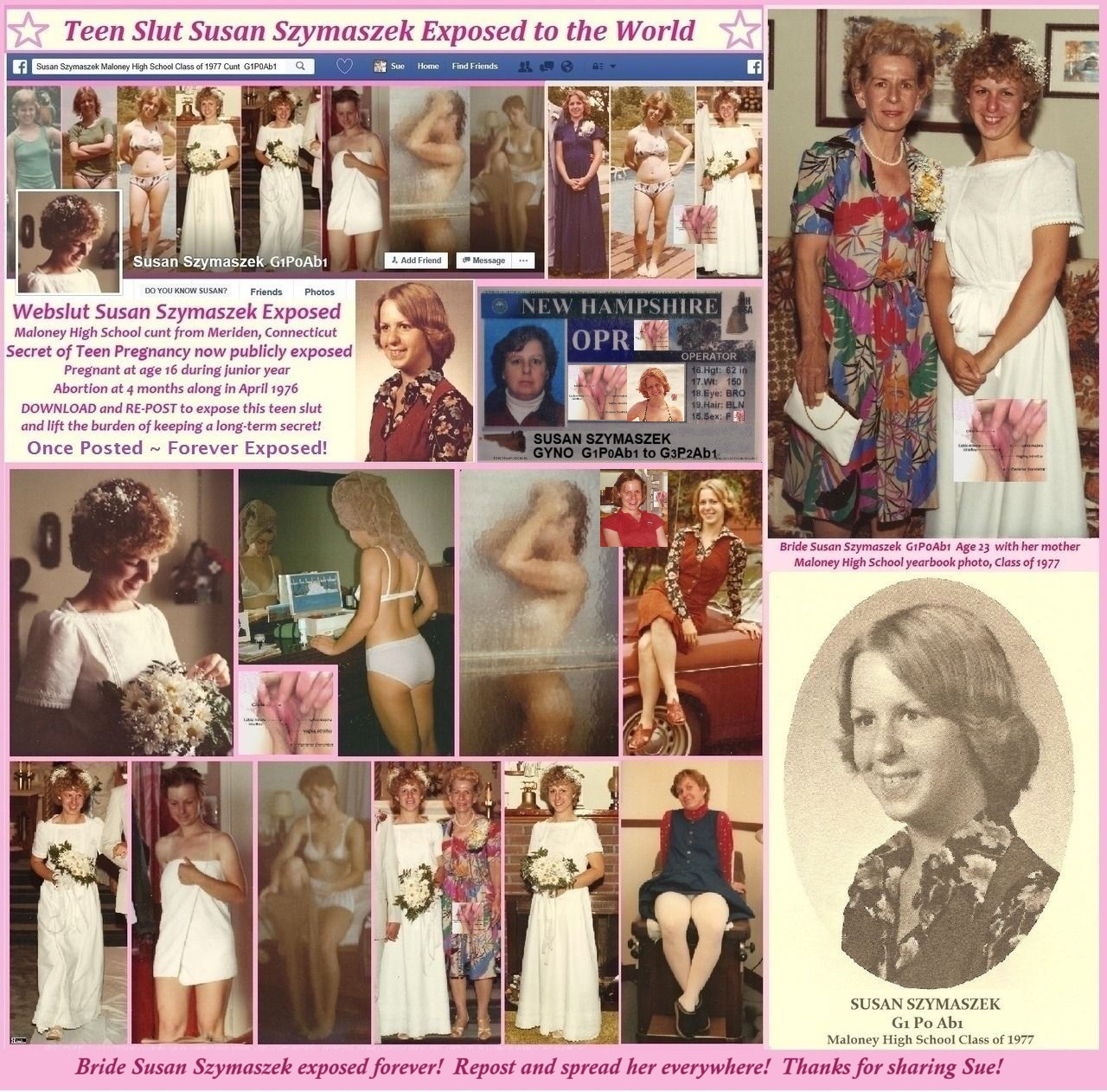 Susan Szymaszek Publicly Exposed Vagina Gyno G1P0Ab1 Maloney High 1977 SchoolGirl Bride Wife Webslut
