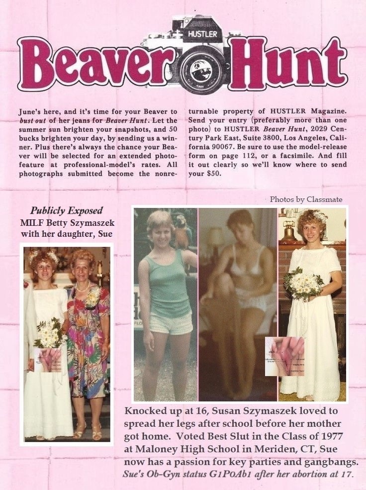 Beaver Hunt girl Susan Szymaszek Publicly Exposed Vagina Gyno G1P0Ab1 Pussy Bride Cunt Wife Webslut