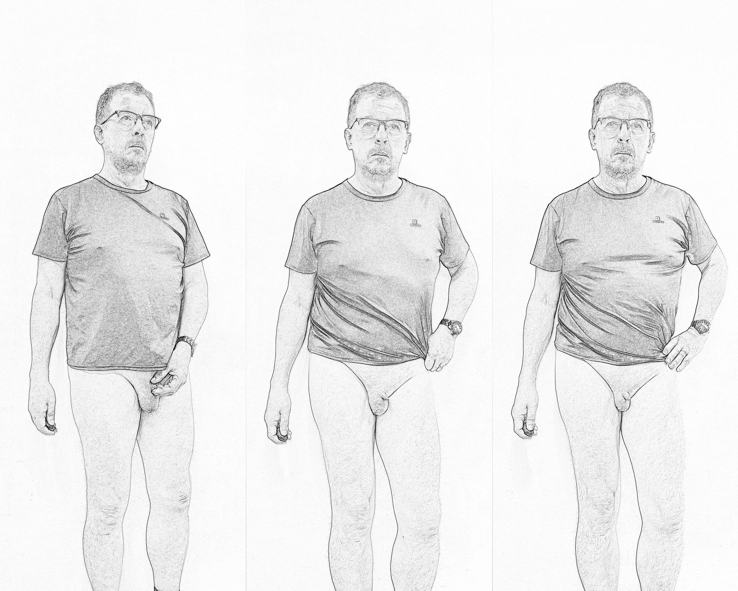 Micropenis view