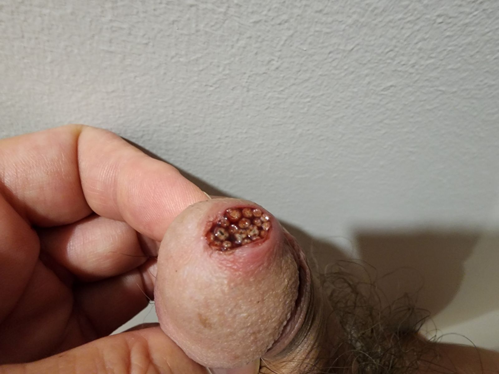 Michel dube cock full of worms exposed 