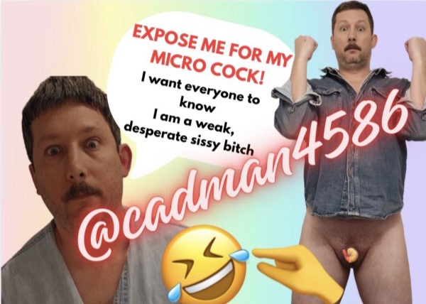 Exposed microdick loser